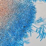 jamur blue stain